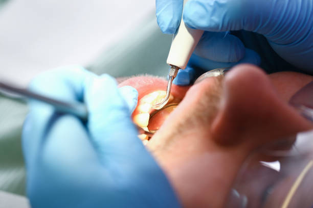 Best Cracked Tooth Emergency Dentist  in Shippensburg University, PA