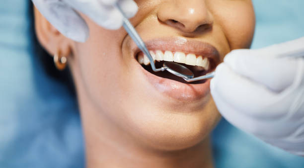 Dentist for Dental Trauma in PA